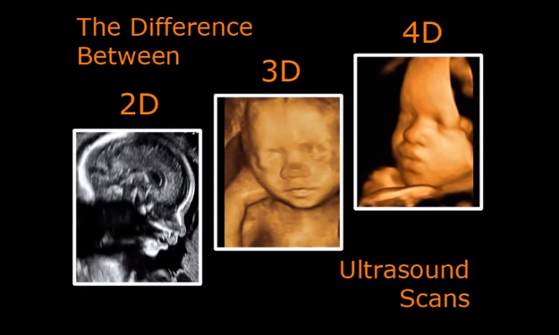 2D/3D/4D Ultrasound Scan