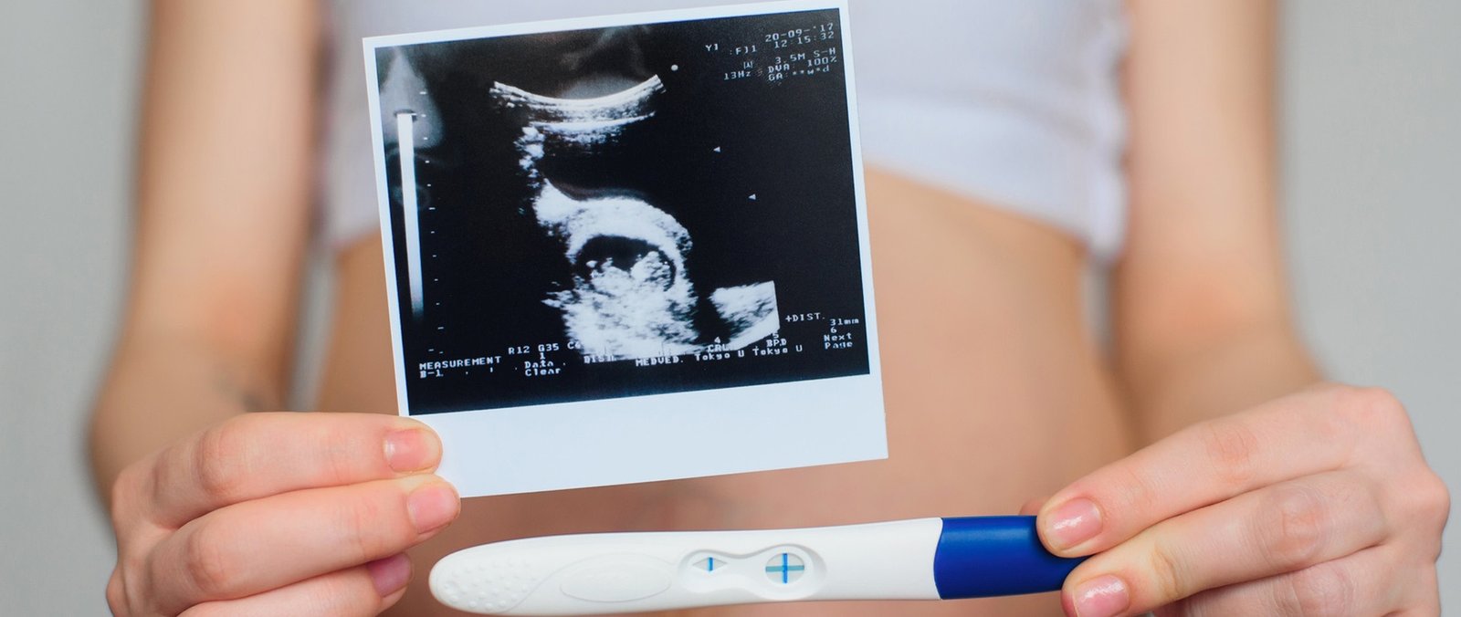 3D/4D Sonography