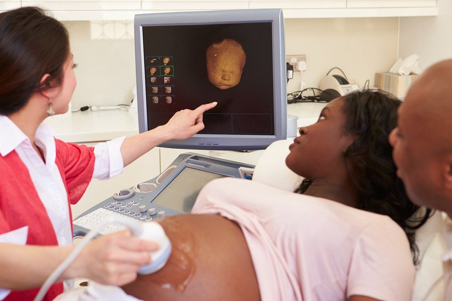 Ultrasound