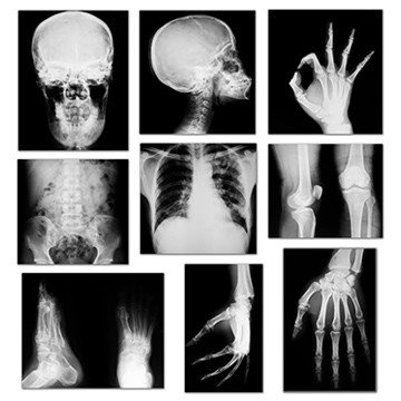 Handy Tips Associated With Getting An Imaging Scan Done