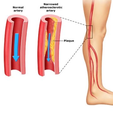 Peripheral Vascular Studies